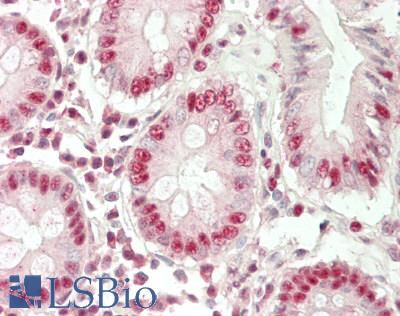 DBP5 / SON Antibody - Human Colon: Formalin-Fixed, Paraffin-Embedded (FFPE)