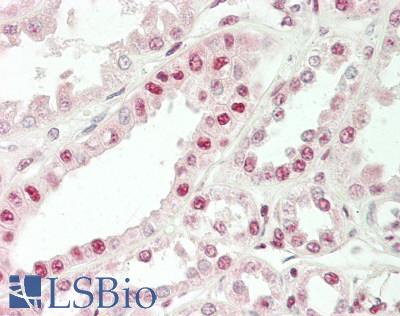 DBP5 / SON Antibody - Human Kidney: Formalin-Fixed, Paraffin-Embedded (FFPE)