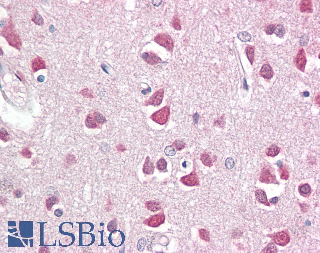DBX2 Antibody - Anti-DBX2 antibody IHC staining of human brain, cortex. Immunohistochemistry of formalin-fixed, paraffin-embedded tissue after heat-induced antigen retrieval.