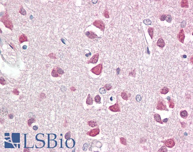 DBX2 Antibody - Anti-DBX2 antibody IHC staining of human brain, cortex. Immunohistochemistry of formalin-fixed, paraffin-embedded tissue after heat-induced antigen retrieval.