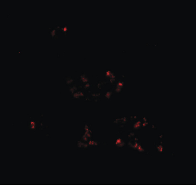 DBX2 Antibody - Immunofluorescence of DBX2 in human kidney tissue with DBX2 antibody at 20 ug/ml.