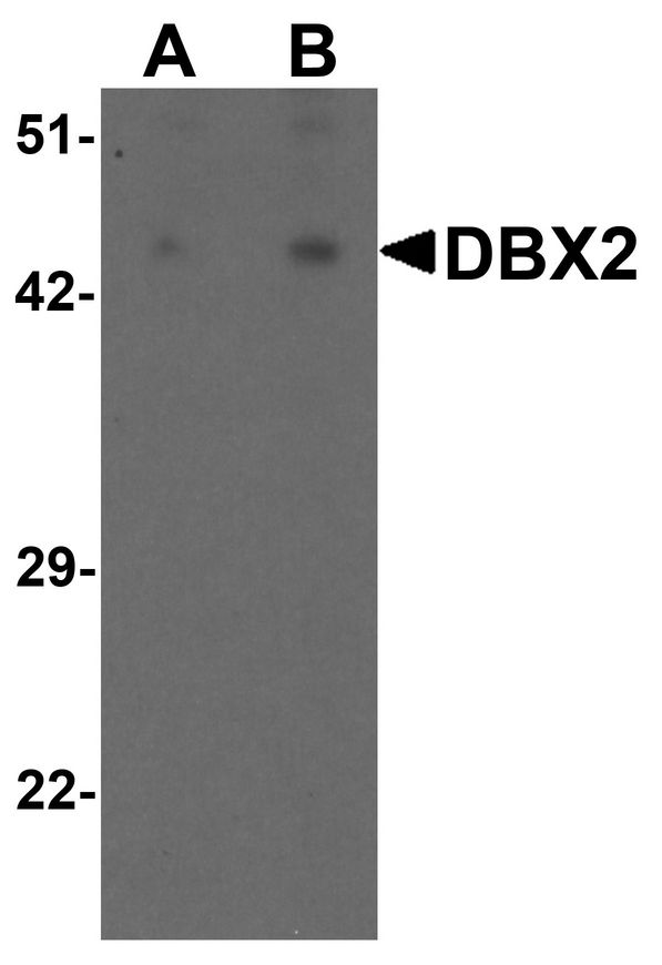 DBX2 Antibody - Western blot analysis of WDR18 in rat lung tissue lysate with WDR18 antibody at (A) 1 and (B) 2 ug/ml.
