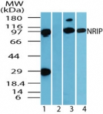 DCAF6 / NRIP Antibody - Western blot of NRIP in human muscle tissue lysate in the 1) absence and 2) presence of immunizing peptide, 3) mouse muscle tissue lysate and 4) rat muscle tissue lysate using antibody at 1 ug/ml.