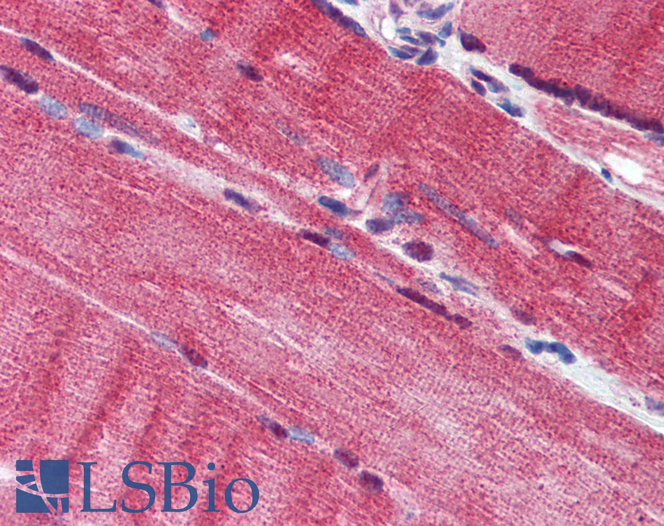 DCAF6 / NRIP Antibody - Anti-DCAF6 / NRIP antibody IHC of human skeletal muscle. Immunohistochemistry of formalin-fixed, paraffin-embedded tissue after heat-induced antigen retrieval. Antibody concentration 10 ug/ml.