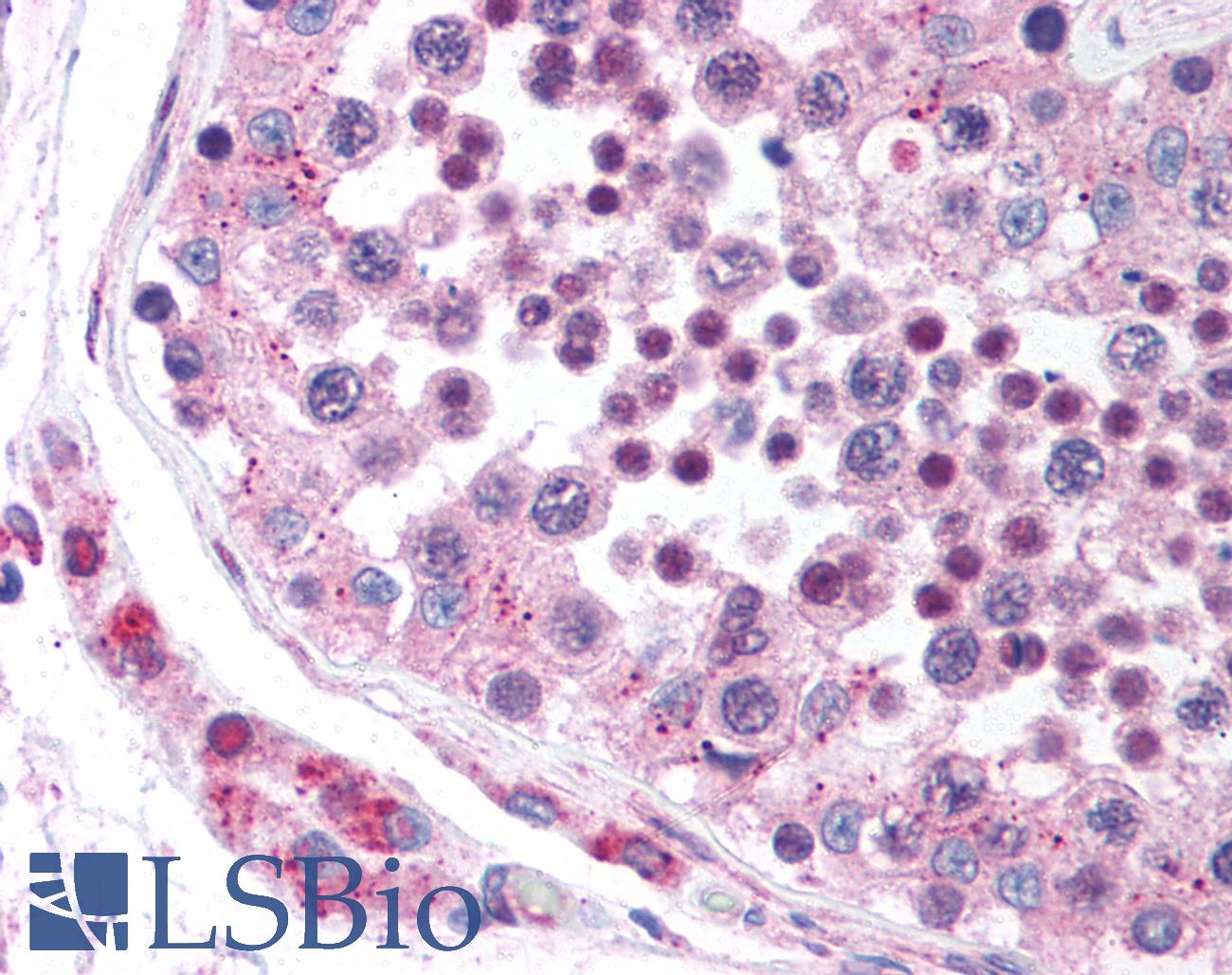 DCBLD2 Antibody - Anti-DCBLD2 antibody IHC of human testis. Immunohistochemistry of formalin-fixed, paraffin-embedded tissue after heat-induced antigen retrieval. Antibody concentration 5 ug/ml.