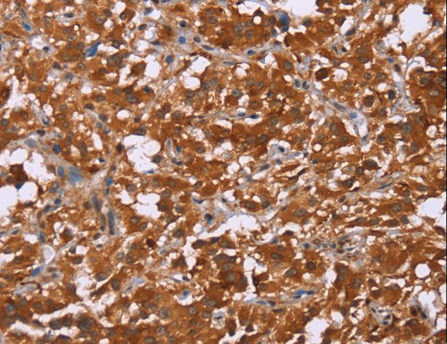 DCBLD2 Antibody - Immunohistochemistry of paraffin-embedded Human brain using DCBLD2 Polyclonal Antibody at dilution of 1:50.