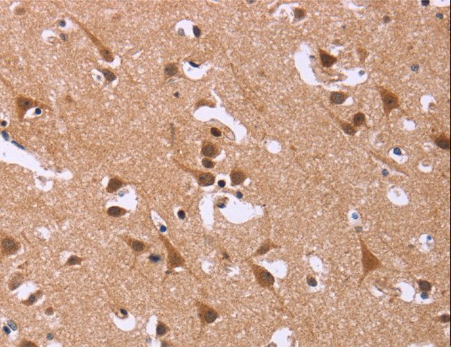DCBLD2 Antibody - Immunohistochemistry of paraffin-embedded Human brain using DCBLD2 Polyclonal Antibody at dilution of 1:50.