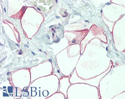 DCBLD2 Antibody - Human Adipose Tissue: Formalin-Fixed, Paraffin-Embedded (FFPE), at a concentration of 10 ug/ml. 