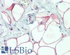 DCBLD2 Antibody - Human Adipose Tissue: Formalin-Fixed, Paraffin-Embedded (FFPE), at a concentration of 10 ug/ml. 