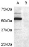 DCDC2 Antibody - Antibody (0.2 ug/ml) staining of COS7 cell lysate transfected with full length recombinant human DCDC2 (A) and untransfected control COS7 cells (B). Primary incubation was 1 hour. Detected by chemiluminescence.