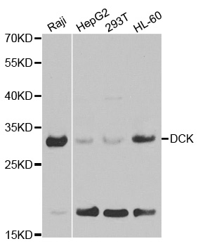 DCK / Deoxycytidine kinase Antibody - Western blot analysis of extracts of various cell lines, using DCK antibody.