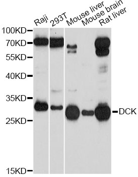 DCK / Deoxycytidine kinase Antibody - Western blot analysis of extracts of various cell lines, using DCK antibody at 1:1000 dilution. The secondary antibody used was an HRP Goat Anti-Rabbit IgG (H+L) at 1:10000 dilution. Lysates were loaded 25ug per lane and 3% nonfat dry milk in TBST was used for blocking. An ECL Kit was used for detection and the exposure time was 10s.