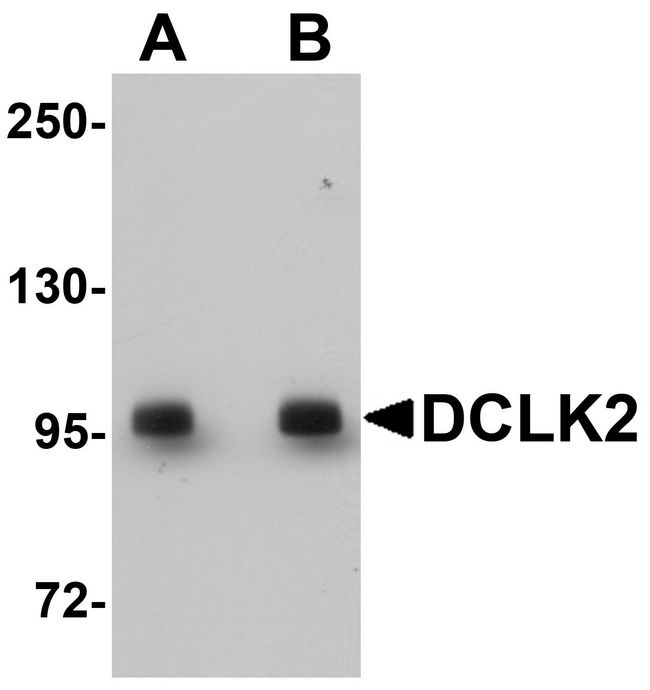 DCLK2 / DCAMKL2 Antibody - Western blot analysis of DCLK2 in rat brain tissue lysate with DCLK2 antibody at (A) 1 and (B) 2 ug/ml.
