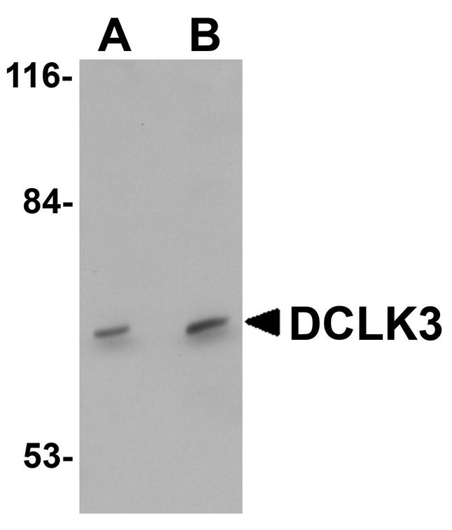 DCLK3 / CLR Antibody - Western blot analysis of DCLK3 in K562 cell lysate with DCLK3 antibody at (A) 1 and (B) 2 ug/ml.