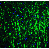 DCLK3 / CLR Antibody - Immunofluorescence of DCLK3 in mouse brain tissue with DCLK3 Antibodyat 20 µg/mL. Green: DCLK3 antibody  Red: Phylloidin staining Blue: DAPI staining