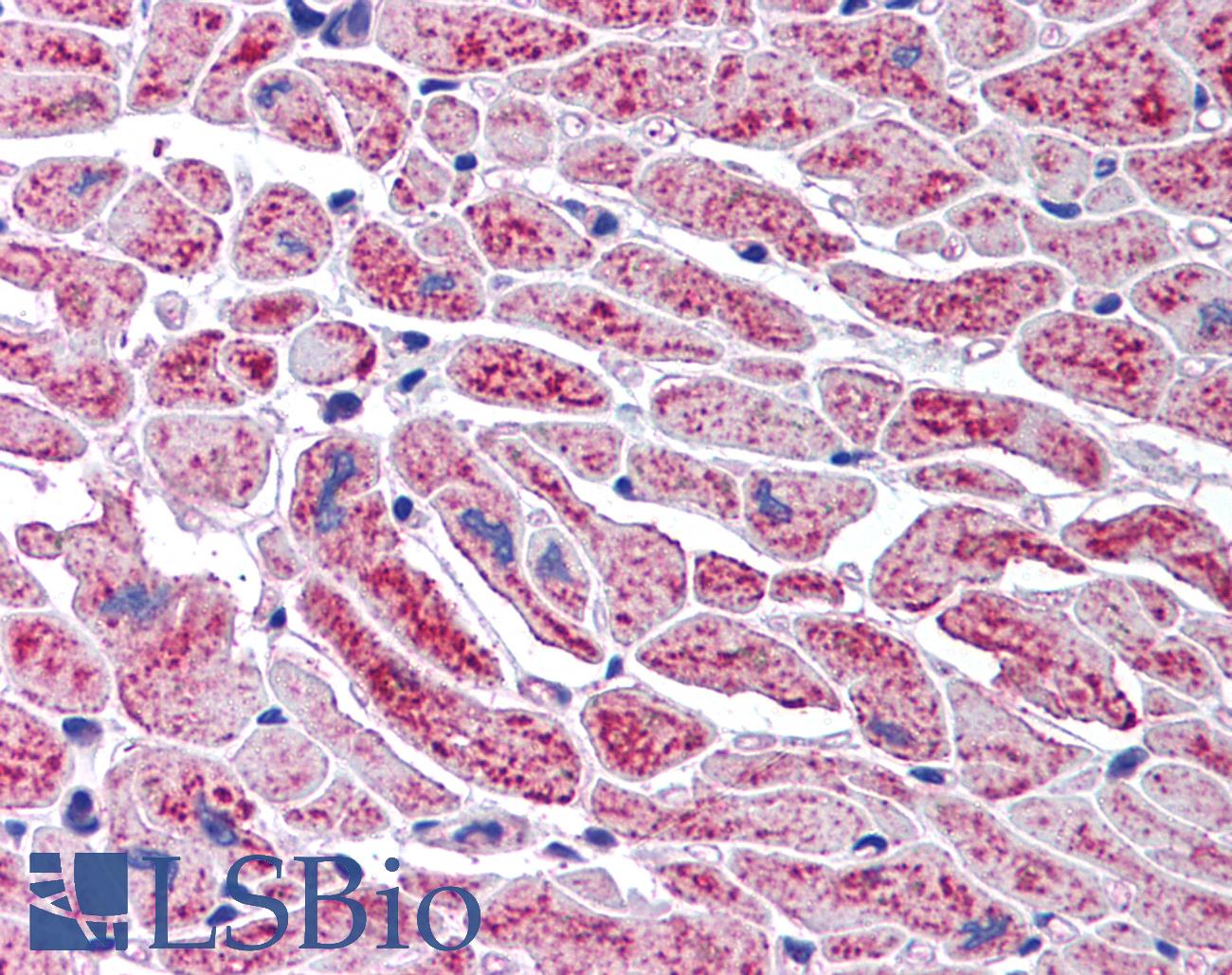 DCLRE1A / SNM1 Antibody - Anti-DCLRE1A / SNM1 antibody IHC of human heart. Immunohistochemistry of formalin-fixed, paraffin-embedded tissue after heat-induced antigen retrieval. Antibody concentration 5 ug/ml.