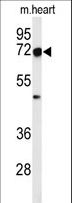 DCLRE1C / Artemis Antibody - Western blot of DCLRE1C Antibody in mouse heart tissue lysates (35 ug/lane). DCLRE1C (arrow) was detected using the purified antibody.