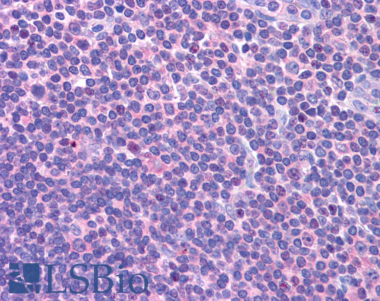 DCLRE1C / Artemis Antibody - Anti-DCLRE1C / ARTEMIS antibody IHC of human lymph node. Immunohistochemistry of formalin-fixed, paraffin-embedded tissue after heat-induced antigen retrieval. Antibody concentration 5 ug/ml.