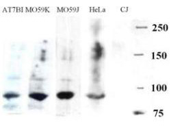 DCLRE1C / Artemis Antibody - Anti-Artemis Antibody - Western Blot. Western blotting. Goat-anti-Artemis was used at a 1:500 dilution to detect Artemis is various cell lysates by Western blot. CJ is an Artemis deficient cell line and so no band is visible.