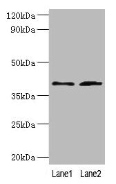 DCN / Decorin Antibody - Western blot All lanes: Decorin antibody at 2µg/ml Lane 1: Mouse heart tissue Lane 2: HepG2 whole cell lysate Secondary Goat polyclonal to rabbit IgG at 1/10000 dilution Predicted band size: 40, 28, 24, 20, 9 kDa Observed band size: 40 kDa