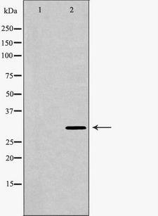DCN / Decorin Antibody - Western blot analysis of mouse liver tissue lysates (30ug per lane) using DCN antibody. The lane on the left is treated with the antigen-specific peptide.