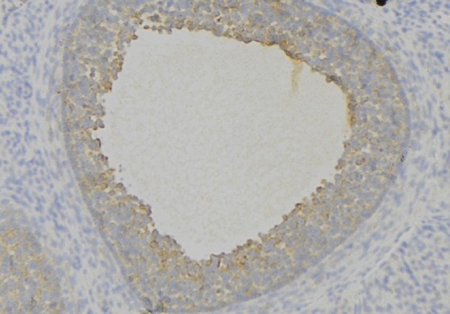 DCN / Decorin Antibody - 1:100 staining human uterus tissue by IHC-P. The sample was formaldehyde fixed and a heat mediated antigen retrieval step in citrate buffer was performed. The sample was then blocked and incubated with the antibody for 1.5 hours at 22°C. An HRP conjugated goat anti-rabbit antibody was used as the secondary.