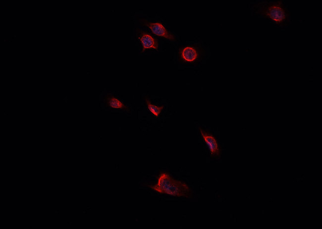 DCN / Decorin Antibody - Staining HepG2 cells by IF/ICC. The samples were fixed with PFA and permeabilized in 0.1% Triton X-100, then blocked in 10% serum for 45 min at 25°C. The primary antibody was diluted at 1:200 and incubated with the sample for 1 hour at 37°C. An Alexa Fluor 594 conjugated goat anti-rabbit IgG (H+L) antibody, diluted at 1/600, was used as secondary antibody.