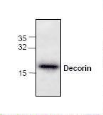 DCN / Decorin Antibody - Western blot of Decorin antibody in Jurkat cell lysate.