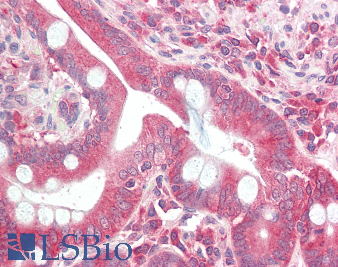 DCP2 Antibody - Anti-DCP2 antibody IHC staining of human small intestine. Immunohistochemistry of formalin-fixed, paraffin-embedded tissue after heat-induced antigen retrieval.