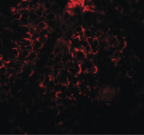 DCP2 Antibody - Immunofluorescence of DCP2 in human testis tissue with DCP2 antibody at 20 ug/ml.