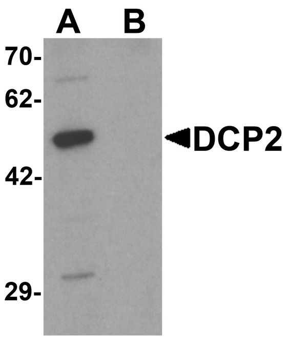 DCP2 Antibody - Western blot analysis of DCP2 in 293 cell lysate with DCP2 antibody at 1 ug/ml in (A) the absence and (B) the presence of blocking peptide.