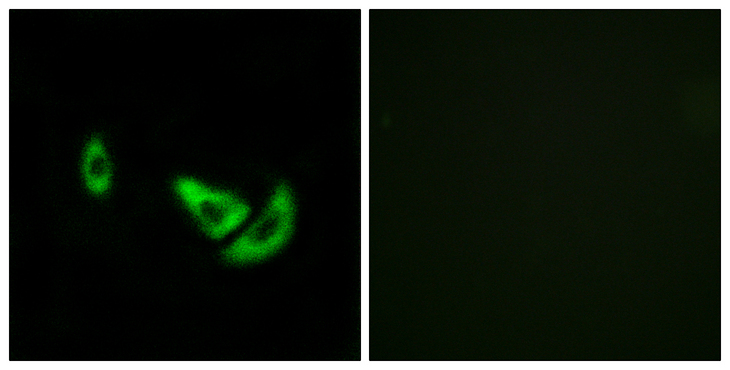 DCT / Dopachrome Tautomerase Antibody - Immunofluorescence analysis of A549 cells, using DCT Antibody. The picture on the right is blocked with the synthesized peptide.