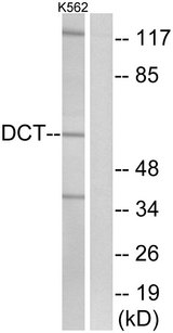 DCT / Dopachrome Tautomerase Antibody - Western blot analysis of lysates from K562 cells, using DCT Antibody. The lane on the right is blocked with the synthesized peptide.