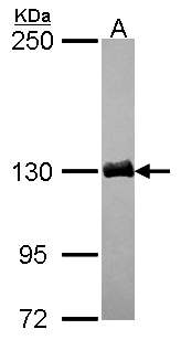 DCTN1 / Dynactin 1 Antibody - Sample (30 ug of whole cell lysate). A: JurKat. 5% SDS PAGE. DCTN1 antibody diluted at 1:3000.