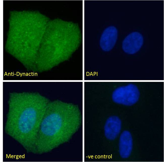 DCTN1 / Dynactin 1 Antibody - DCTN1 / Dynactin 1 antibody immunofluorescence analysis of paraformaldehyde fixed U2OS cells, permeabilized with 0.15% Triton. Primary incubation 1hr (10ug/ml) followed by Alexa Fluor 488 secondary antibody (2ug/ml), showing cytoplasmic staining. The nuclear stain is DAPI (blue). Negative control: Unimmunized goat IgG (10ug/ml) followed by Alexa Fluor 488 secondary antibody (2ug/ml).