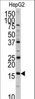 DCTPP1 / XTP3TPA Antibody - Western blot of anti-XTP3TPA Antibody in HepG2 cell line lysates (35 ug/lane). XTP3TPA(arrow) was detected using the purified antibody.
