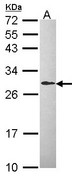 DCXR Antibody - Sample (30 ug of whole cell lysate). A: Hep G2 . 12% SDS PAGE. DCXR antibody diluted at 1:1000.