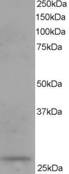 DCXR Antibody - Antibody staining (0.1 ug/ml) of human kidney lysate (RIPA buffer, 35 ug total protein per lane). Primary incubated for 1 hour. Detected by Western blot of chemiluminescence.