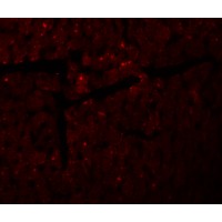 DDA1 Antibody - Immunofluorescence of DDA1 in mouse heart tissue with DDA1 antibody at 20 µg/mL.