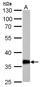 DDH / AKR1C1 Antibody - Western blot analysis of Anti-AKR1C1 antibody (LS-B10819, 1:1000 dilution; 50 µg of lysate/extract per lane). Lane 1: Mouse liver lysate/extract. Antibody produced band at ~37 kDa.