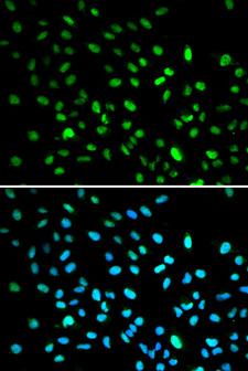 DDIT3 / CHOP Antibody - Immunofluorescence analysis of A549 cell using DDIT3 antibody. Blue: DAPI for nuclear staining.