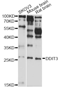 DDIT3 / CHOP Antibody - Western blot analysis of extracts of various cell lines, using DDIT3 antibody at 1:1000 dilution. The secondary antibody used was an HRP Goat Anti-Rabbit IgG (H+L) at 1:10000 dilution. Lysates were loaded 25ug per lane and 3% nonfat dry milk in TBST was used for blocking. An ECL Kit was used for detection and the exposure time was 20s.
