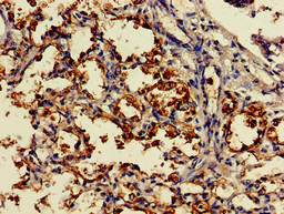 DDO / D-Aspartate Oxidase Antibody - Immunohistochemistry of paraffin-embedded human lung tissue using DDO Antibody at dilution of 1:100