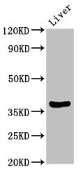 DDO / D-Aspartate Oxidase Antibody - Western Blot Positive WB detected in: Rat liver tissue All lanes: DDO antibody at 3.5µg/ml Secondary Goat polyclonal to rabbit IgG at 1/50000 dilution Predicted band size: 38, 31, 41, 34 kDa Observed band size: 38 kDa