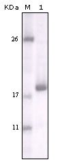 DDR2 Antibody - Western blot using DDR2 mouse monoclonal antibody against truncated DDR2 recombinant protein.