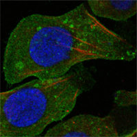 DDR2 Antibody - Confocal immunofluorescence of A549 cells using DDR2 mouse monoclonal antibody (green). Red: Actin filaments have been labeled with DY-554 phalloidin. Blue: DRAQ5 fluorescent DNA dye.