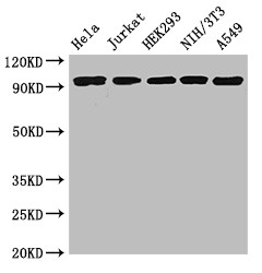 DDR2 Antibody - Positive WB detected in:Hela whole cell lysate,Jurkat whole cell lysate,HEK293 whole cell lysate,NIH/3T3 whole cell lysate,A549 whole cell lysate;All lanes:DDR2 antibody at 3.5?g/ml;Secondary;Goat polyclonal to rabbit IgG at 1/50000 dilution;Predicted band size: 97 KDa;Observed band size: 97 KDa;