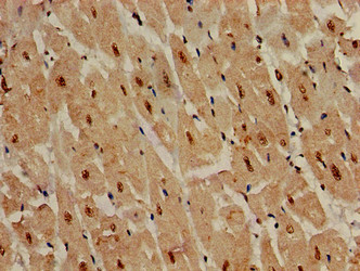 DDR2 Antibody - Immunohistochemistry of paraffin-embedded human heart tissue using DDR2 Antibody at dilution of 1:100