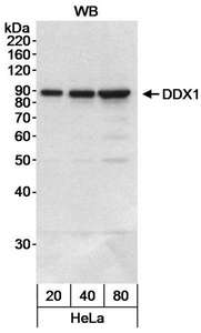 DDX1 Antibody - Detection of Human DDX1 by Western Blot. Sample: Whole cell lysate (20, 40 and 80 ug) from HeLa cells. Antibody: Affinity purified rabbit anti-DDX1 antibody used at 0.03 ug/ml. Detection: Chemiluminescence with an exposure time of 30 seconds.