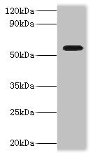 DDX19A Antibody - Western blot All lanes: ATP-dependent RNA helicase DDX19A antibody at 2µg/ml + Mouse gonad tissue Secondary Goat polyclonal to rabbit IgG at 1/10000 dilution Predicted band size: 54, 44 kDa Observed band size: 54 kDa